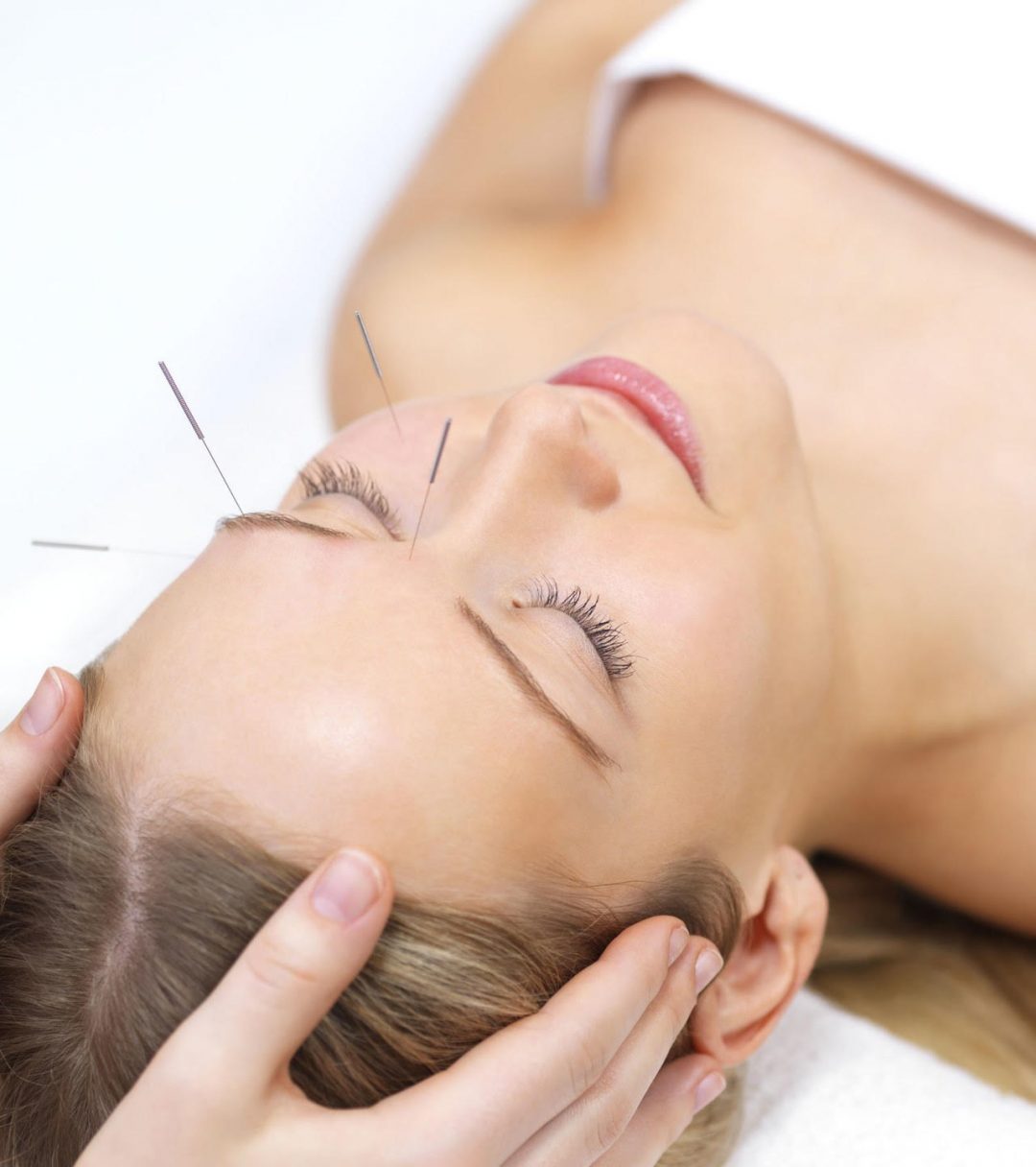 Anti-ageing Facial Acupuncture